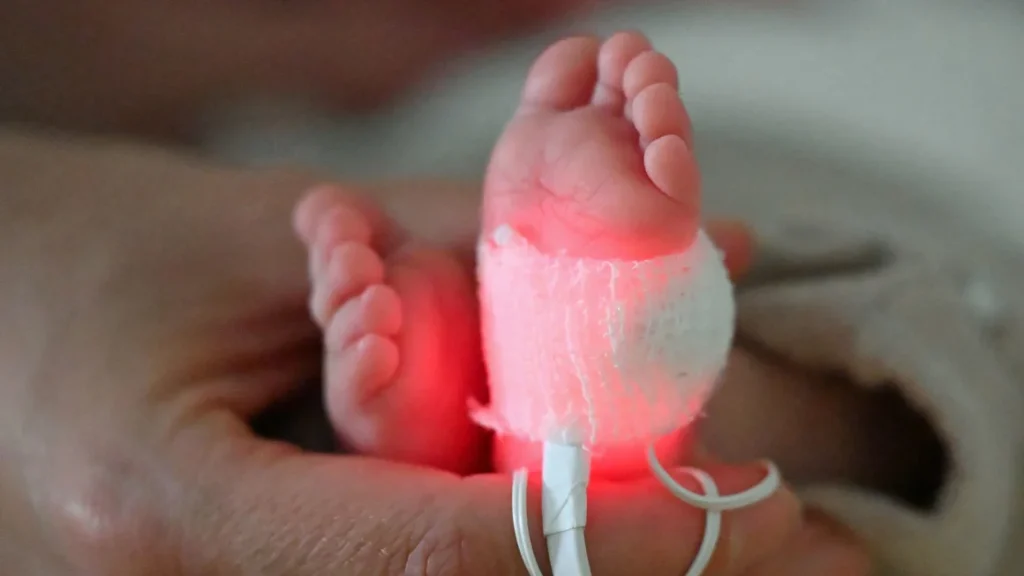 Millones de nacimientos prematuros y miles de muertes de recién nacidos están vinculadas a un químico del plástico