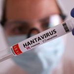 Julio Castro descarta riesgo epidemiológico importante por hantavirus