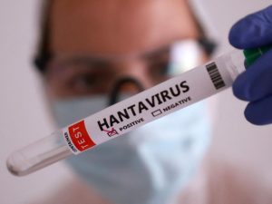 Julio Castro descarta riesgo epidemiológico importante por hantavirus